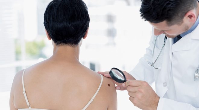 Melanoma: la concientización y prevención son las claves para vencerlo