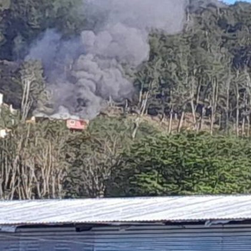 Franca recuperación del joven que intentó evitar que se le incendiara la casa