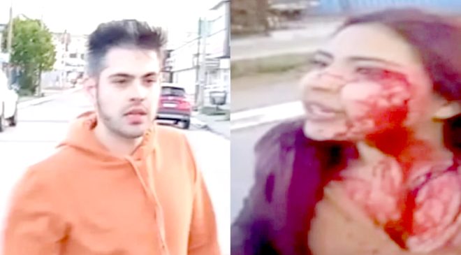 Juzgan a un hombre por desfigurar a una mujer con un vidrio
