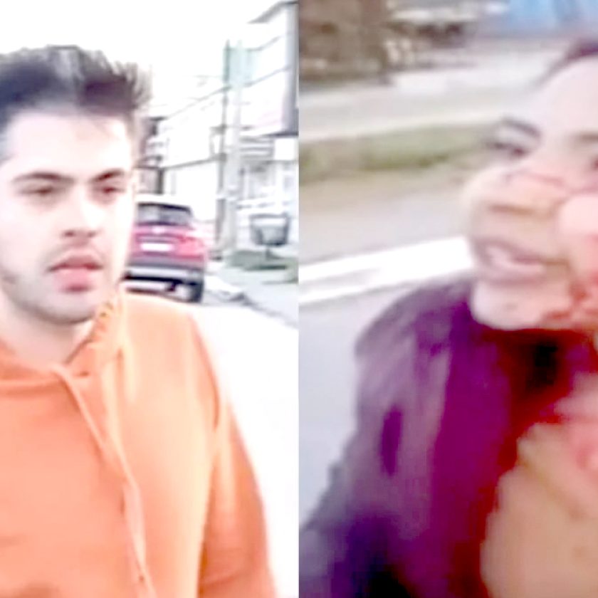 Juzgan a un hombre por desfigurar a una mujer con un vidrio